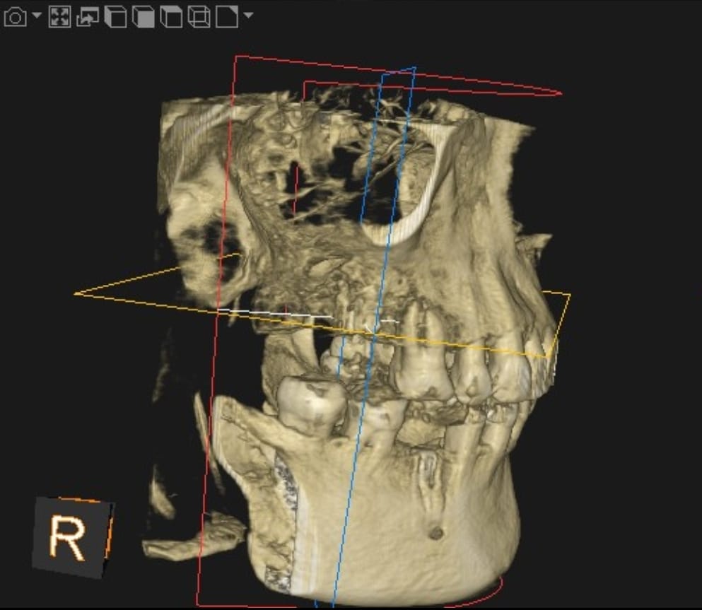 3d-cbct-scan