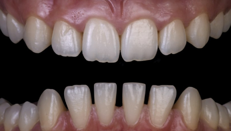 Discover Digital Smile Design (DSD)